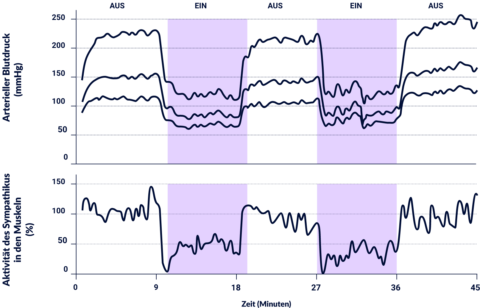 Liniendiagramme, die zeigen, dass Barostim die Aktivität des Sympathikus in den Muskeln bei Patienten mit resistenter Hypertonie reduziert